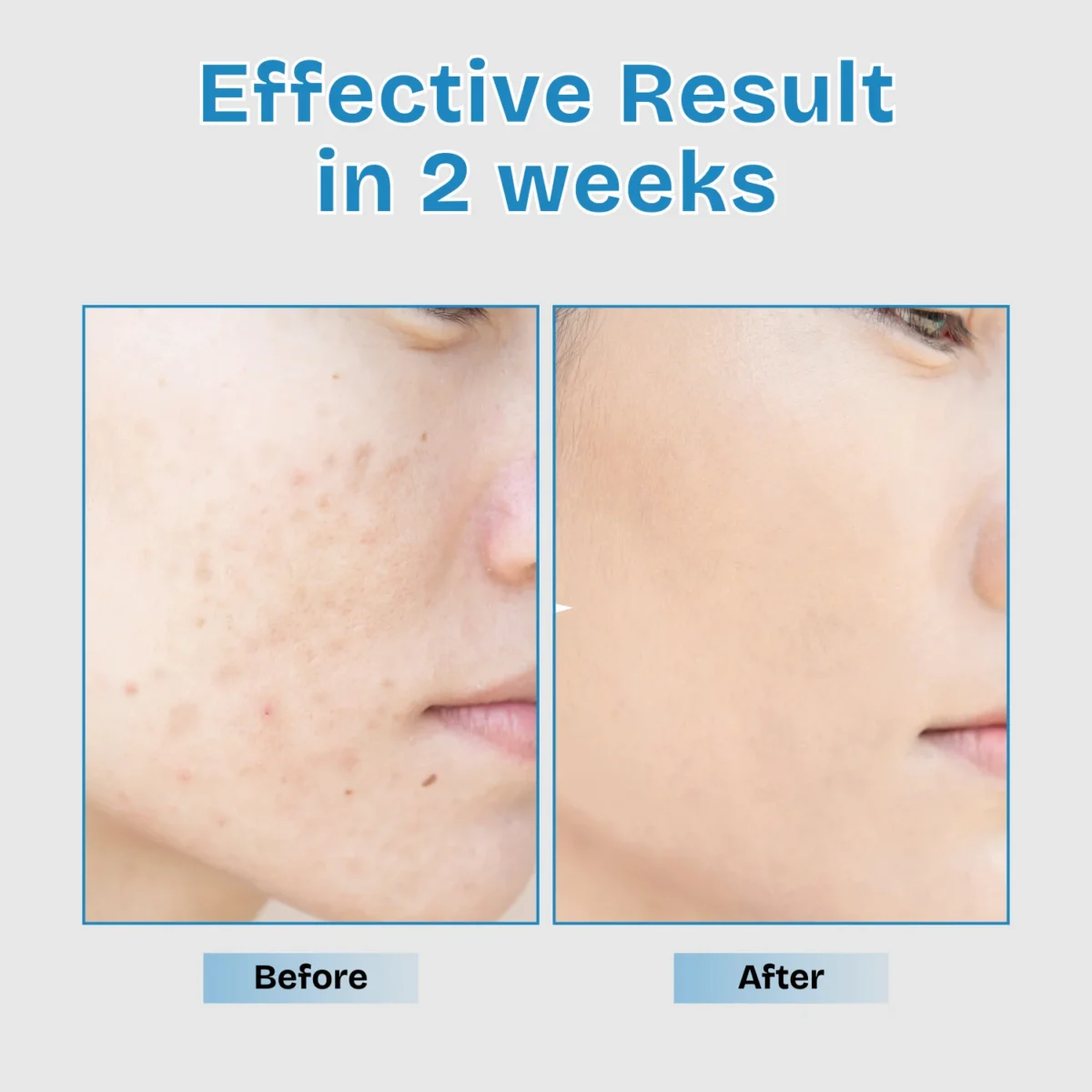 serum for dark spots