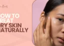 How to Treat Dry Skin Naturally