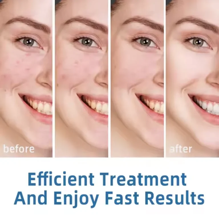 Stem cell serum