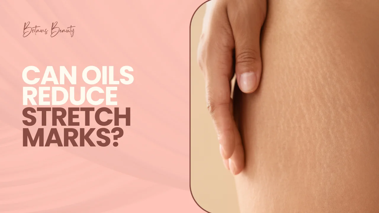 Can Oils Reduce Stretch Marks